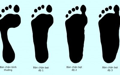 Cách chọn giày theo dáng Chân và Cơ thể Cách chọn giày theo dáng Chân và Cơ thể
