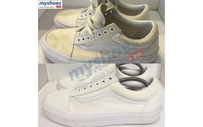 Khắc phục giày bị ố vàng của bạn bằng 5 cách đơn giản nhất